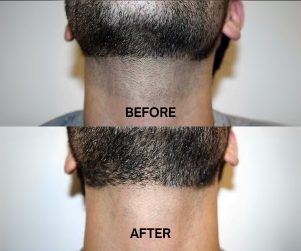 befor-after-image